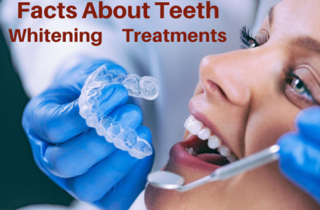 Facts About Teeth Whitening Treatments