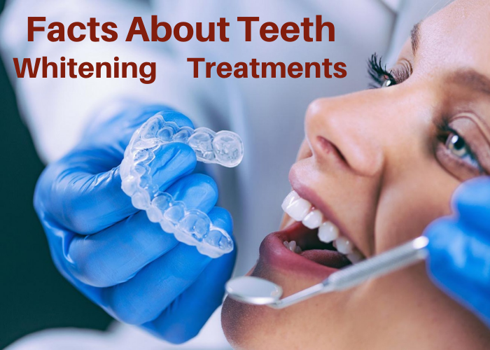 Facts About Teeth Whitening Treatments