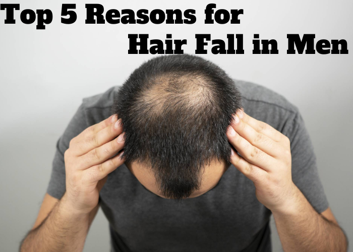 Top 5 Reasons for Hair Fall in Men